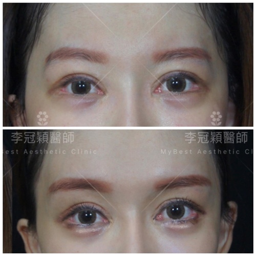 Traditional_brow_pad-case2