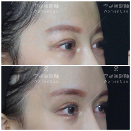 Traditional_brow_pad-case3