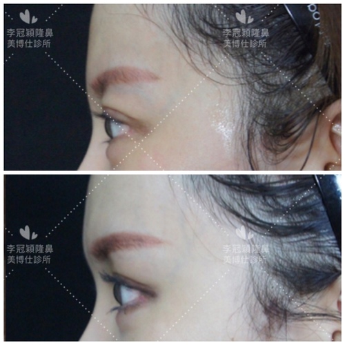 Traditional_brow_pad-case4