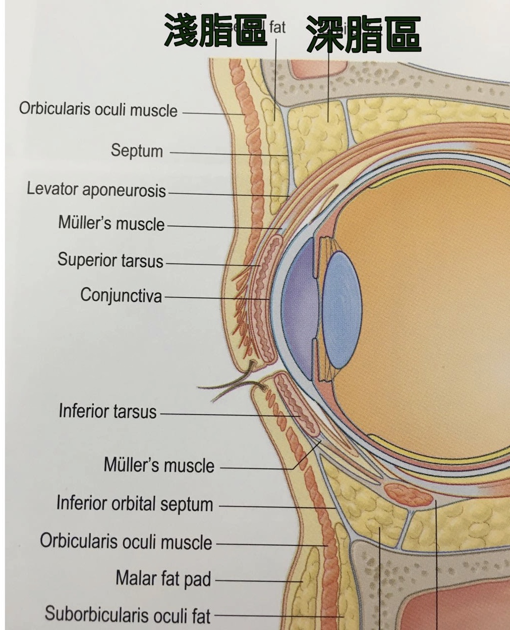 concave-eye眼凹-眼球周圍解剖剖面圖